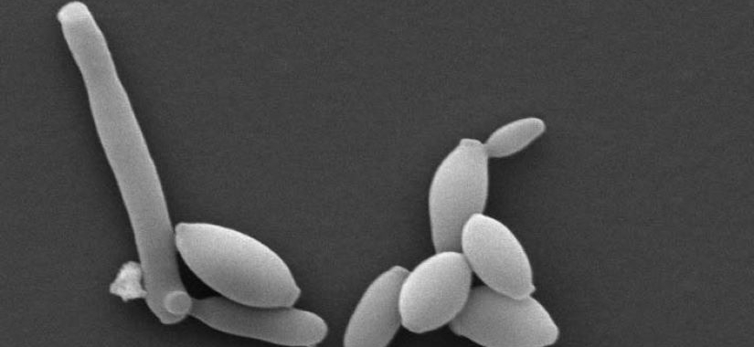 Lutte contre Brettanomyces, bilan de trois années d'expérimentation